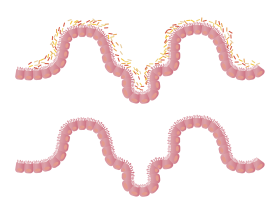 Darmbacterien2