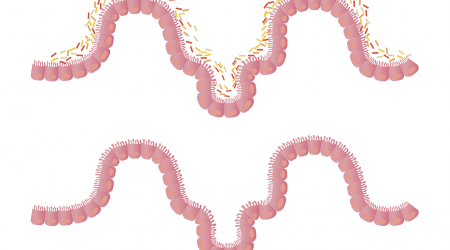 Darmbacterien2