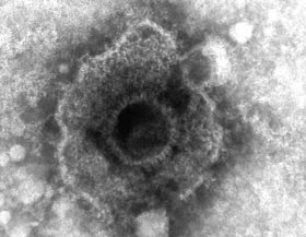 Herpesvirus_negative_staining_Wikimedia