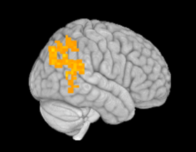 Nath_MECFS_brain-fMRI