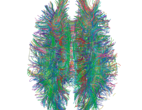 White_Matter_Connections_MRI