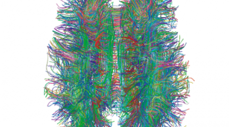 White_Matter_Connections_MRI